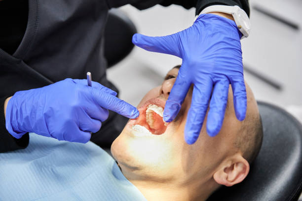 Best Emergency Tooth Extraction in Kraemer, LA