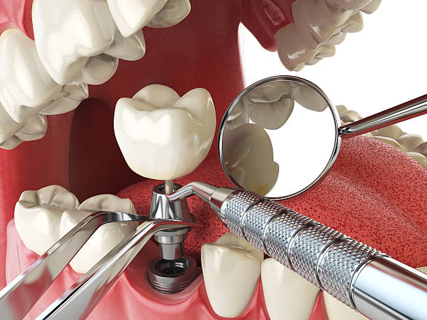 Best Emergency Orthodontic Services in Kraemer, LA