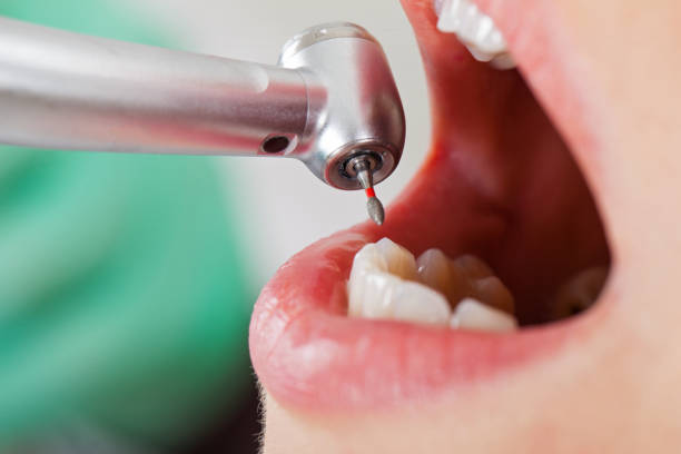Best Emergency Gum Treatment in Kraemer, LA